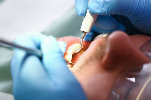 Best Pediatric Emergency Dentist in Surfside, FL