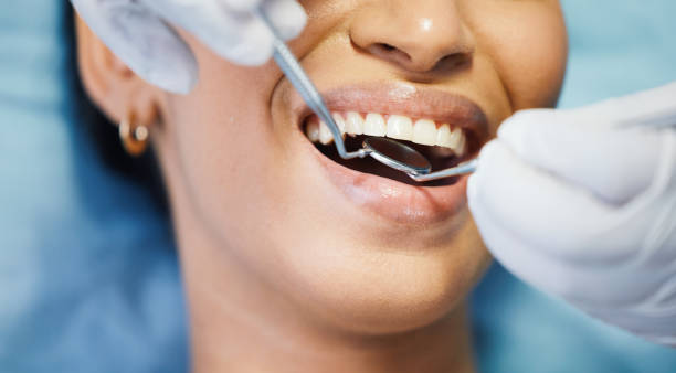 Best Emergency Tooth Extraction in Surfside, FL